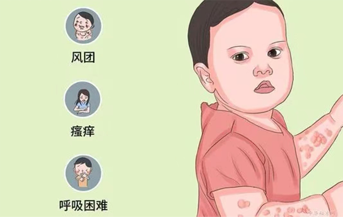 荨麻疹、皮肤痒？得了应该注意啥？