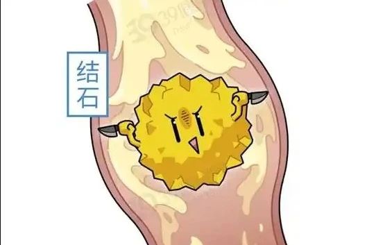 “难言之隐”不必隐忍：关注女性泌尿健康，远离疾病困扰